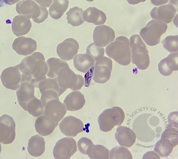 Plasmodium falciparum- male gametocyte