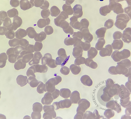 Plasmodium falciparum- female gametocyte