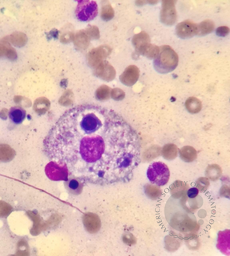 Hemophagocytosis