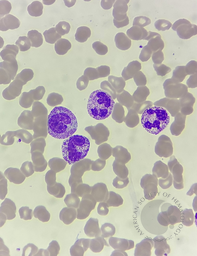 toxic granules