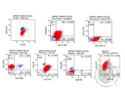 ETP-ALL immunophenotyping