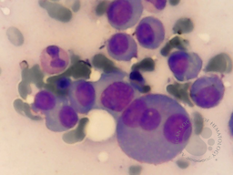 Sheet of Plasma Cells 1