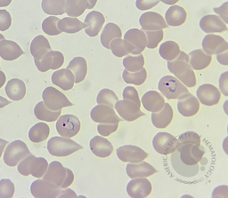 Developmental stages of Plasmodium vivax 1