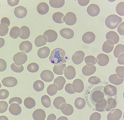 Developmental stages of Plasmodium vivax 2