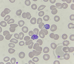 Developmental stages of Plasmodium vivax 3
