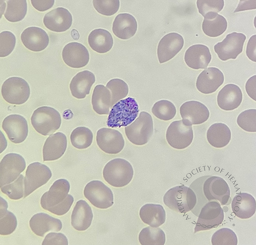 Developmental stages of Plasmodium vivax 4
