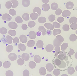 Large Platelets