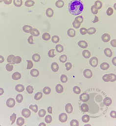 Schistocytes