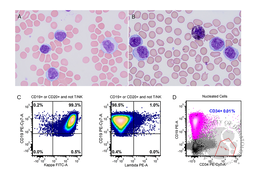 Atypical Chronic Lymphocytic Leukemia Cells With Auer Rods-like Inclusions
