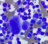Micromegakaryocyte