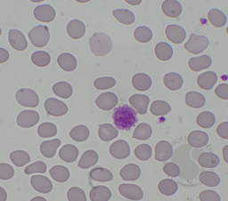 Giant Platelet