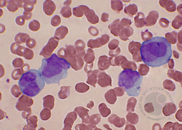 Promyelocyte