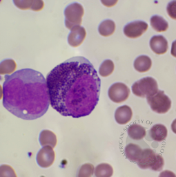 Basophilic Myelocyte