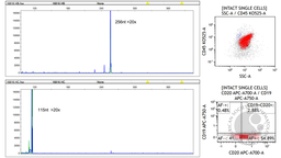 DLBCL- CSF IGH PCR and flow cytometry
