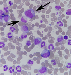 CML(2)