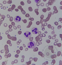 Neutrophil