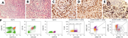 Flow cytometry–based evaluation of TRBC1/TRBC2 facilitates identification of indolent T-lymphoblastic proliferations