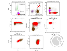 T-cell large granular lymphocytic leukemia 2