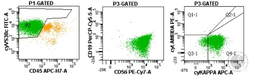 Myeloma Flow Cytometry