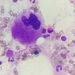 MEGAKARYOCYTE