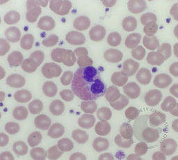 Eosinophil