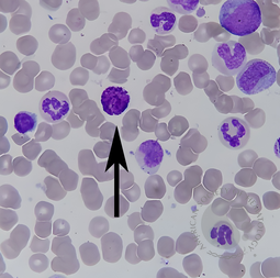 Basophil(2)