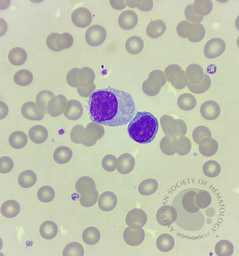 Plasma cell