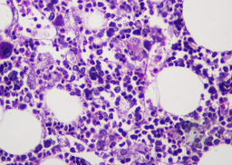 H&E-stained trephine biopsy,