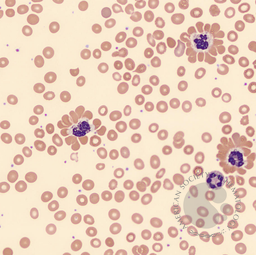 Neutrophil-erythrocyte rosette 2