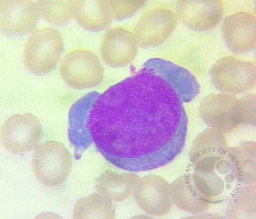 Parvovirus B19 (erythrovirus)