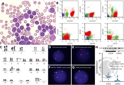 B-lymphoblastic leukemia with synchronous KMT2A::TXNRD1 and IGH::CEBPD rearrangements