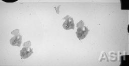 RC_WSI_NDPI_IMG_1