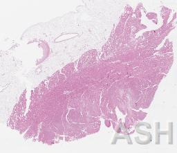 REF_WSI_CAT_SVS_IMG_2