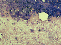AT_1_IB